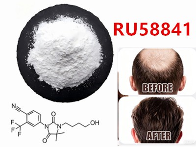 RU58841이 탈모 치료의 열쇠가 될 수 있을까?